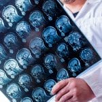 Doctor holding brain scan imagery
